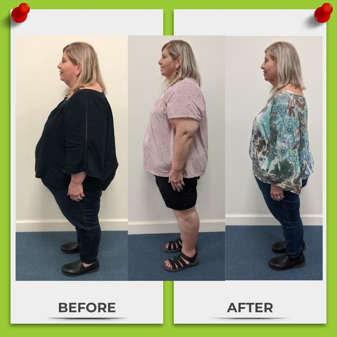 Client 3-angle before and after