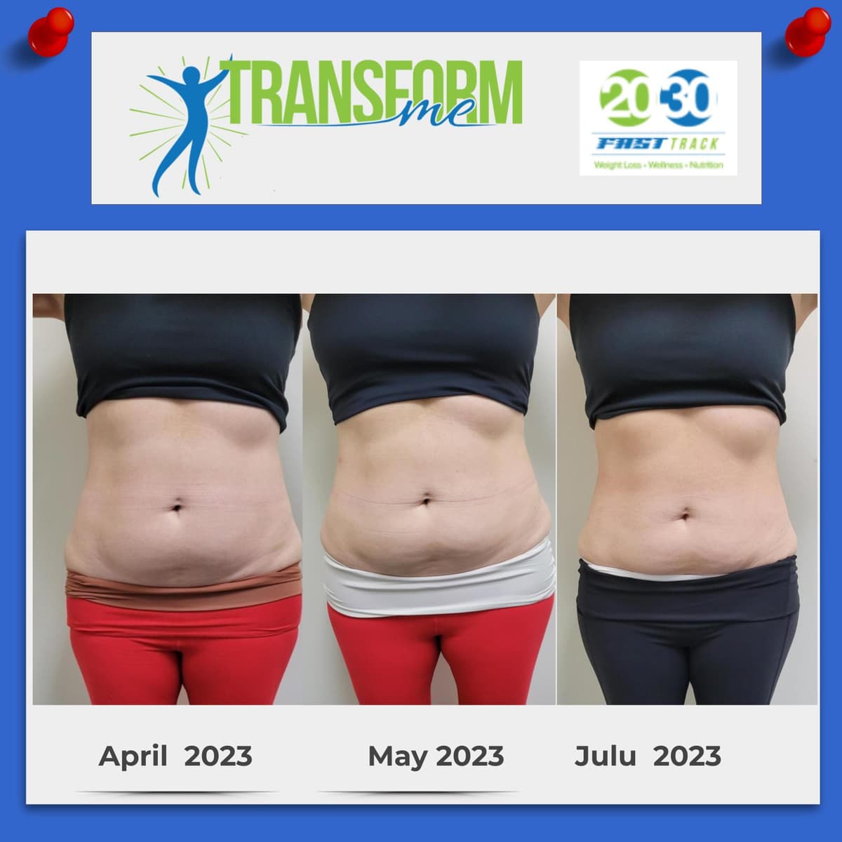 Venus Bliss before and after front view July 2023