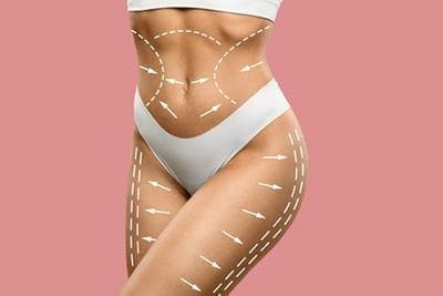 Venus Bliss body contouring at Transform Me NC